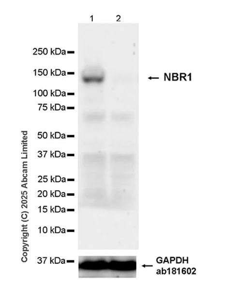 Western blot - Anti-NBR1 antibody [EPR30441-637] (AB324910)