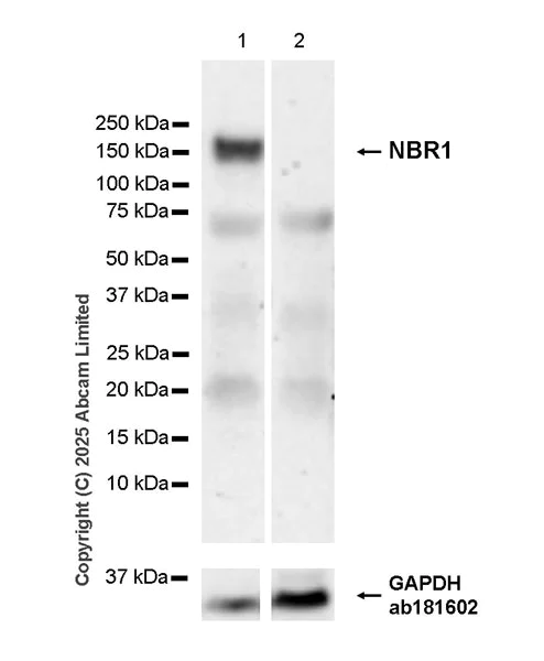 Western blot - Anti-NBR1 antibody [EPR30441-637] (AB324910)