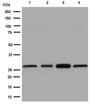 Western blot - Anti-NC2 alpha antibody [EPR15426(B)] - BSA and Azide free (AB250699)