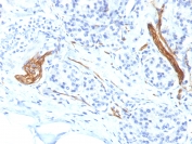 Immunohistochemistry (Formalin/PFA-fixed paraffin-embedded sections) - Anti-NCAM antibody [NCAM1/1496] (AB218467), expandable thumbnail