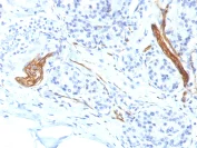 Immunohistochemistry (Formalin/PFA-fixed paraffin-embedded sections) - Anti-NCAM antibody [NCAM1/1496] (AB218467)