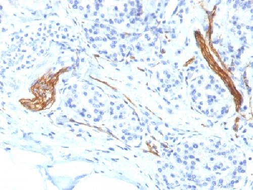 Immunohistochemistry (Formalin/PFA-fixed paraffin-embedded sections) - Anti-NCAM antibody [NCAM1/1496] - BSA and Azide free (AB218925)