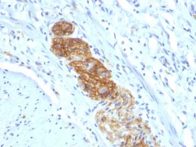 Immunohistochemistry (Formalin/PFA-fixed paraffin-embedded sections) - Anti-NCAM antibody [NCAM1/784] (AB216019)