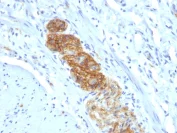 Immunohistochemistry (Formalin/PFA-fixed paraffin-embedded sections) - Anti-NCAM antibody [NCAM1/784] - BSA and Azide free (AB216010)