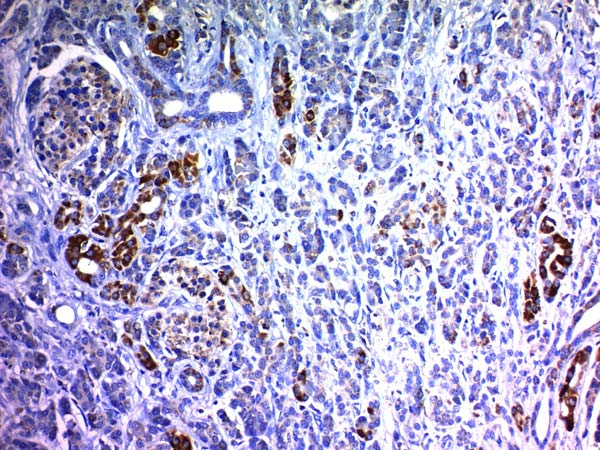 Immunohistochemistry (Formalin/PFA-fixed paraffin-embedded sections) - Anti-NCAM1 antibody [123C3.D5 + 123A8] (AB200698)