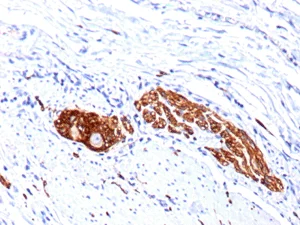 Immunohistochemistry (Formalin/PFA-fixed paraffin-embedded sections) - Anti-NCAM1 antibody [123C3.D5 + 123A8] (AB200698)