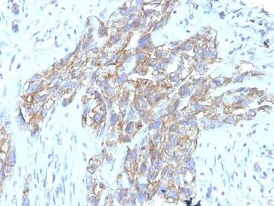 Immunohistochemistry (Formalin/PFA-fixed paraffin-embedded sections) - Anti-NCAM1 antibody [123C3.D5 + 123A8] - BSA and Azide free (AB233944)