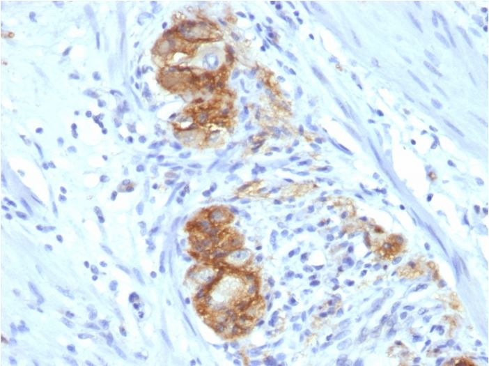 Immunohistochemistry (Formalin/PFA-fixed paraffin-embedded sections) - Anti-NCAM1 antibody [123C3.D5] (AB270248)