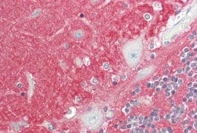 Immunohistochemistry (Formalin/PFA-fixed paraffin-embedded sections) - Anti-NCAM1 antibody [1G4] (AB230724)