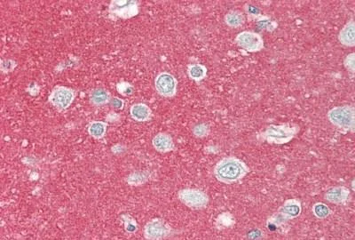 Immunohistochemistry (Formalin/PFA-fixed paraffin-embedded sections) - Anti-NCAM1 antibody [1G4] (AB230724)