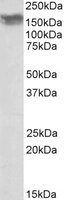 Western blot - Anti-NCAM1 antibody (AB118291), expandable thumbnail