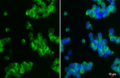 Immunocytochemistry/ Immunofluorescence - Anti-NCAM1 antibody (AB154566)