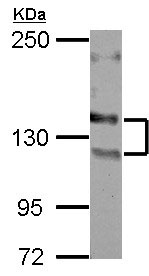 Western blot - Anti-NCAM1 antibody (AB154566), expandable thumbnail