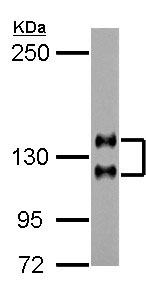 Western blot - Anti-NCAM1 antibody (AB154566), expandable thumbnail