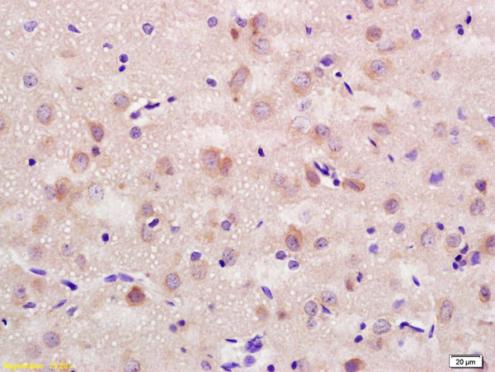 Immunohistochemistry (Formalin/PFA-fixed paraffin-embedded sections) - Anti-NCAM1 antibody (AB202980), expandable thumbnail
