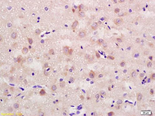 Immunohistochemistry (Formalin/PFA-fixed paraffin-embedded sections) - Anti-NCAM1 antibody (AB202980)