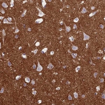 Immunohistochemistry (Formalin/PFA-fixed paraffin-embedded sections) - Anti-NCAM1 antibody (AB204446)