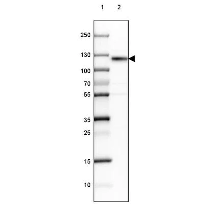 Western blot - Anti-NCAM1 antibody (AB204446)