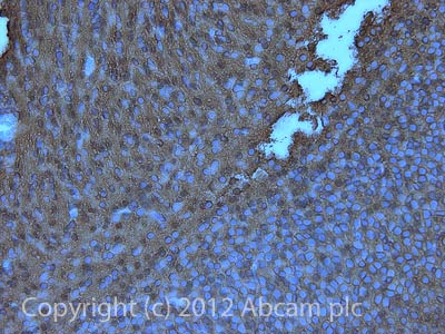 Immunohistochemistry (Formalin/PFA-fixed paraffin-embedded sections) - Anti-NCAM1 antibody (AB95153)