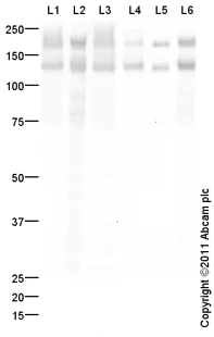 Western blot - Anti-NCAM1 antibody (AB95153)
