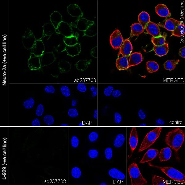 Immunocytochemistry/ Immunofluorescence - Anti-NCAM1 antibody [CAL53] (AB237708)