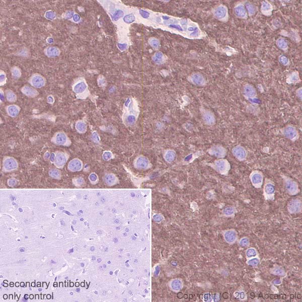 Immunohistochemistry (Formalin/PFA-fixed paraffin-embedded sections) - Anti-NCAM1 antibody [CAL53] (ab237708), expandable thumbnail