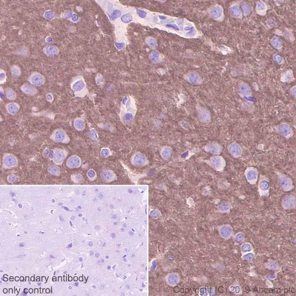 Immunohistochemistry (Formalin/PFA-fixed paraffin-embedded sections) - Anti-NCAM1 antibody [CAL53] (AB237708)