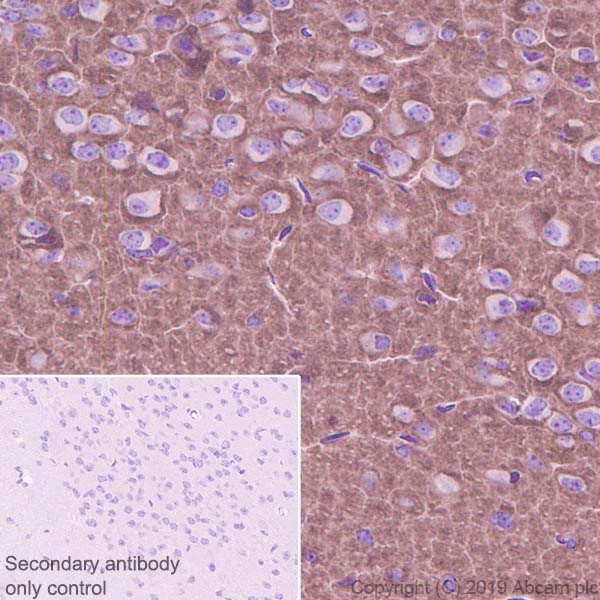 Immunohistochemistry (Formalin/PFA-fixed paraffin-embedded sections) - Anti-NCAM1 antibody [CAL53] (AB237708), expandable thumbnail