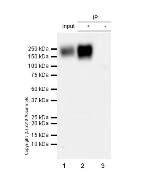 Immunoprecipitation - Anti-NCAM1 antibody [CAL53] (AB237708), expandable thumbnail