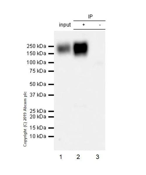 Immunoprecipitation - Anti-NCAM1 antibody [CAL53] (AB237708)