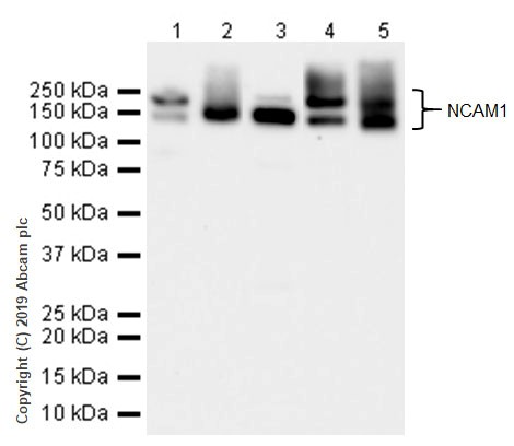 Western blot - Anti-NCAM1 antibody [CAL53] (AB237708), expandable thumbnail