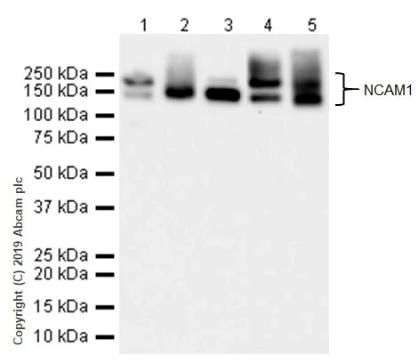 Western blot - Anti-NCAM1 antibody [CAL53] (AB237708)