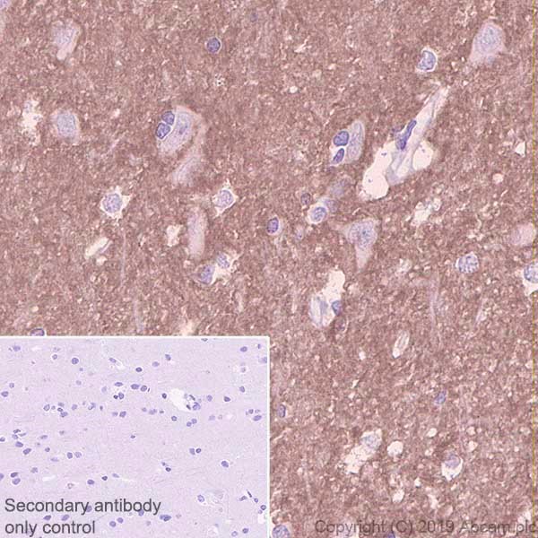 Immunohistochemistry (Formalin/PFA-fixed paraffin-embedded sections) - Anti-NCAM1 antibody [CAL53] - BSA and Azide free (AB251595)