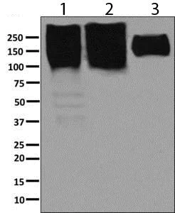 Western blot - Anti-NCAM1 antibody [EP2566(2)] - BSA and Azide free (AB248809)