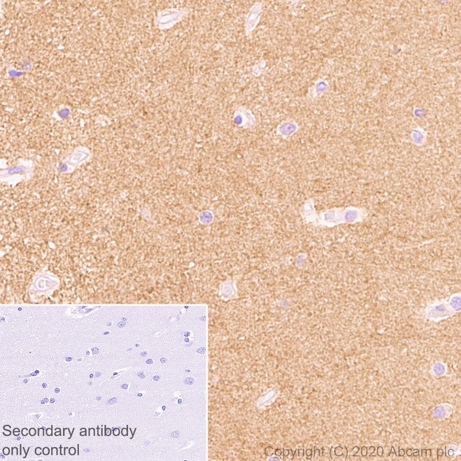 Immunohistochemistry (Formalin/PFA-fixed paraffin-embedded sections) - Anti-NCAM1 antibody [EP2567Y] - BSA and Azide free (AB214435), expandable thumbnail