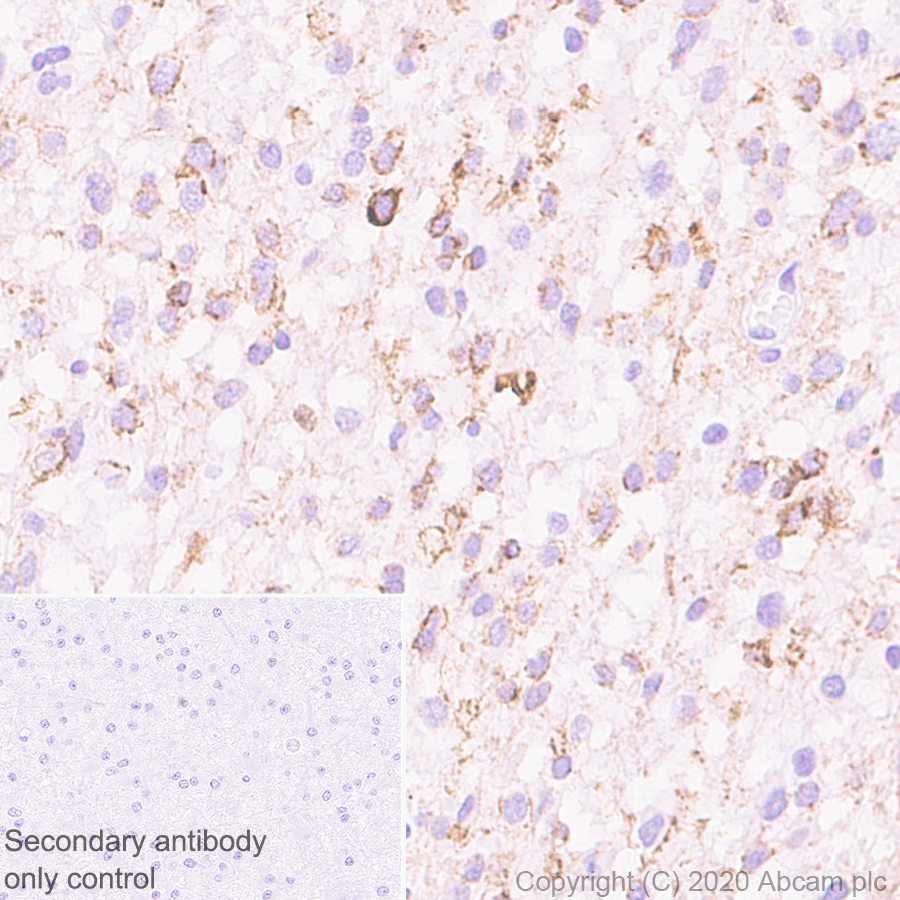 Immunohistochemistry (Formalin/PFA-fixed paraffin-embedded sections) - Anti-NCAM1 antibody [EP2567Y] - BSA and Azide free (ab214435), expandable thumbnail