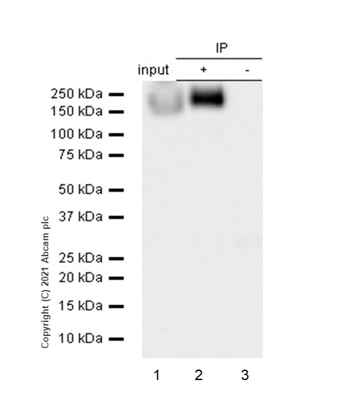 Immunoprecipitation - Anti-NCAM1 antibody [EP2567Y] - BSA and Azide free (AB214435), expandable thumbnail