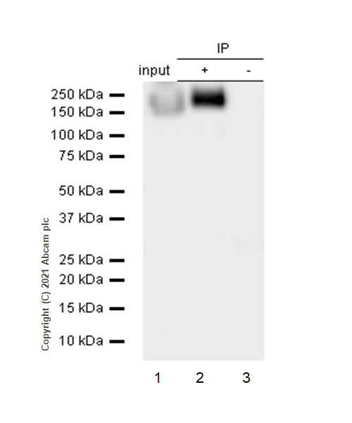 Immunoprecipitation - Anti-NCAM1 antibody [EP2567Y] - BSA and Azide free (AB214435)