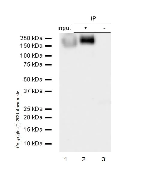 Immunoprecipitation - Anti-NCAM1 antibody [EP2567Y] - Low endotoxin, Azide free (AB215981)