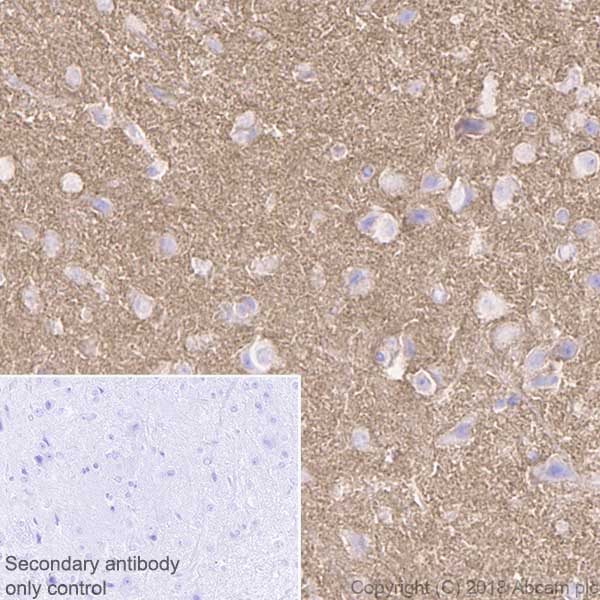 Immunohistochemistry (Formalin/PFA-fixed paraffin-embedded sections) - Anti-NCAM1 antibody [EPR21827] (AB220360), expandable thumbnail