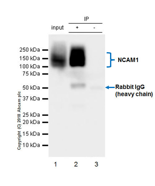 Immunoprecipitation - Anti-NCAM1 antibody [EPR21827] (ab220360), expandable thumbnail