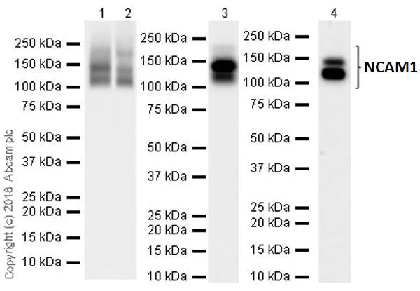 Western blot - Anti-NCAM1 antibody [EPR21827] (AB220360)