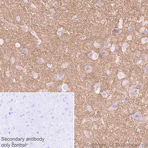 Immunohistochemistry (Formalin/PFA-fixed paraffin-embedded sections) - Anti-NCAM1 antibody [EPR21827] - BSA and Azide free (AB231826)