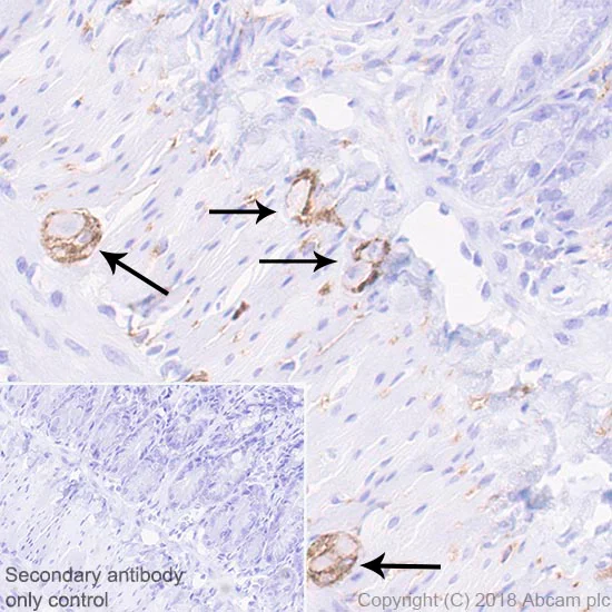 Immunohistochemistry (Formalin/PFA-fixed paraffin-embedded sections) - Anti-NCAM1 antibody [EPR21827] - BSA and Azide free (AB231826)