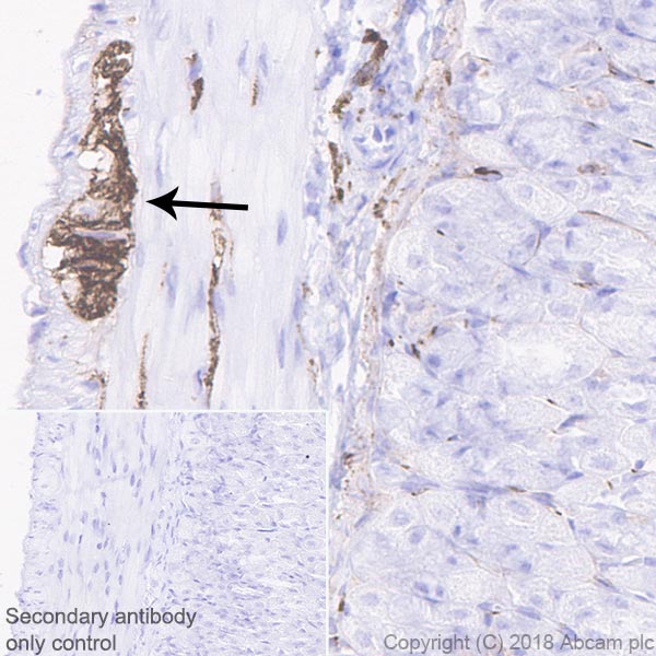 Immunohistochemistry (Formalin/PFA-fixed paraffin-embedded sections) - Anti-NCAM1 antibody [EPR21827] - BSA and Azide free (AB231826)