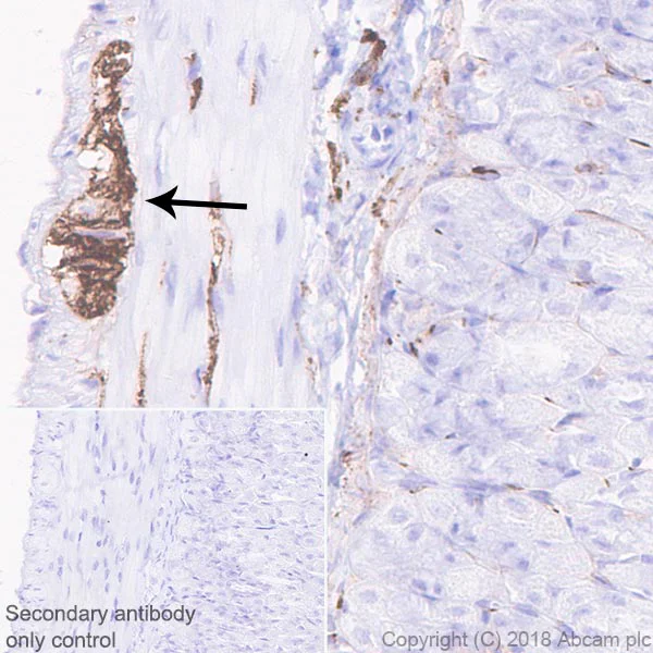 Immunohistochemistry (Formalin/PFA-fixed paraffin-embedded sections) - Anti-NCAM1 antibody [EPR21827] - BSA and Azide free (AB231826)