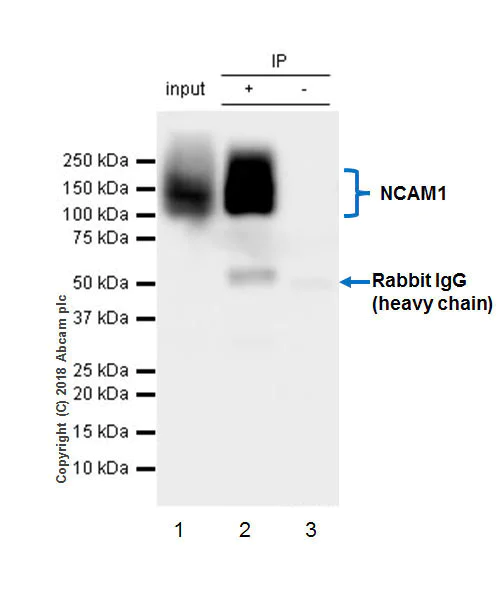 Immunoprecipitation - Anti-NCAM1 antibody [EPR21827] - BSA and Azide free (AB231826)