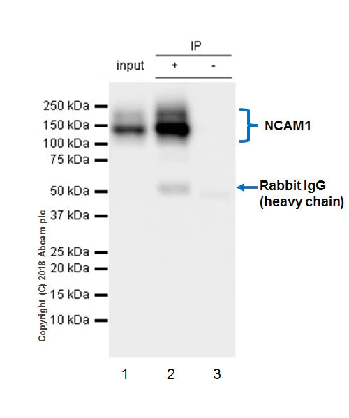 Immunoprecipitation - Anti-NCAM1 antibody [EPR21827] - BSA and Azide free (AB231826)