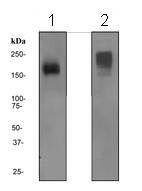 Western blot - Anti-NCAM1 antibody [EPR2566] (AB133345), expandable thumbnail
