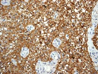 Immunohistochemistry (Formalin/PFA-fixed paraffin-embedded sections) - Anti-NCAM1 antibody [EPR2566] - BSA and Azide free (AB214436)